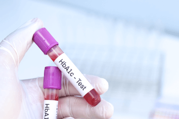 Silver Health Package in Banjara Hills 