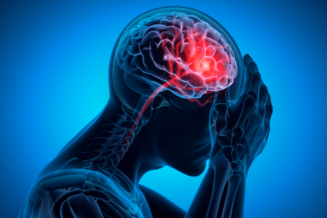 Stroke Risk Screening Package in Outpatient Centre, Banjara Hills
