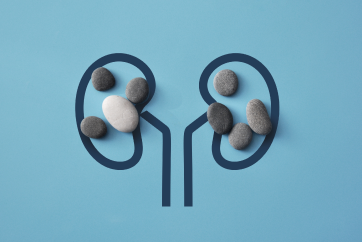 Basic Kidney Stone Health Check-up Package in Banjara Hills