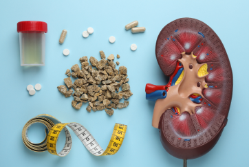 Advanced kidney stone health check up package in Banjara Hills