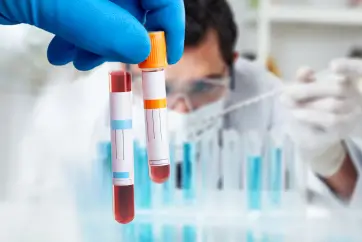 Full Body Silver Health Package in Outpatient Centre, Banjara Hills