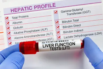 Full Body Diamond Female Health Package in Outpatient Centre, Banjara Hills