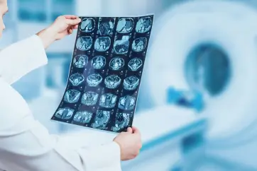 Cancer Screening Male Health Package in Outpatient Centre, Banjara Hills