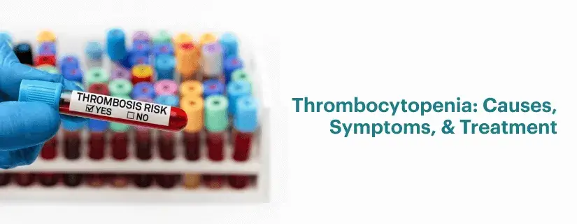 Thrombocytopenia: Causes, Symptoms, and Treatment