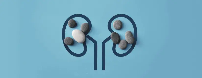 3 Kidney Stone Warning Signs You Should Never Ignore