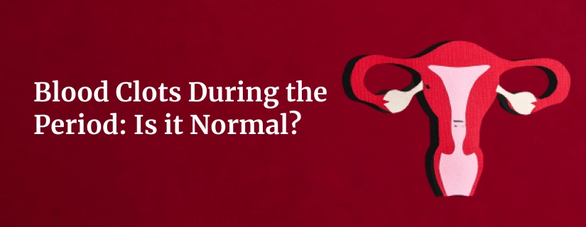 Are Blood Clots During the Period Normal?