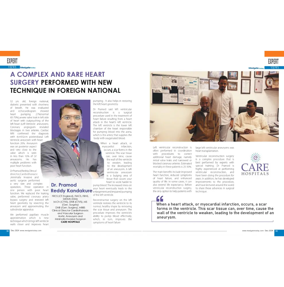 New Technique for Rare Heart Surgery by Dr. Promod Reddy Kandakure in Medigate Today
