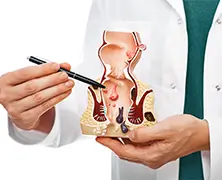 Difference between Piles, Fissures, and Fistula