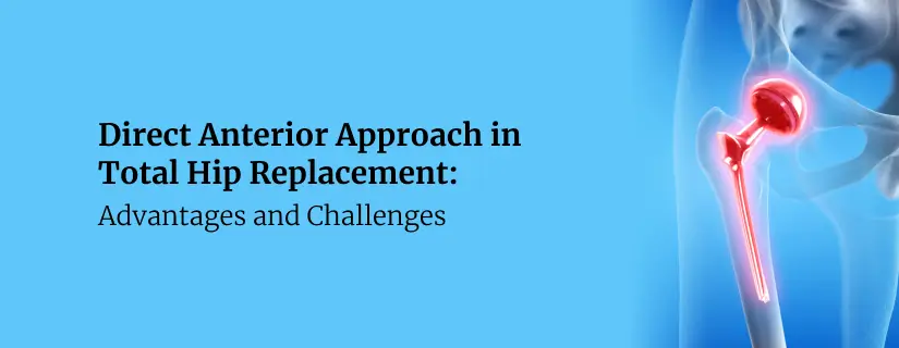 Direct Anterior Approach in Total Hip Replacement