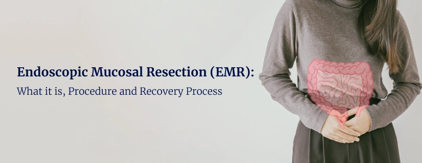 Endoscopic Mucosal Resection (EMR)