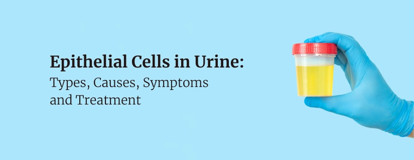 Epithelial Cells in Urine