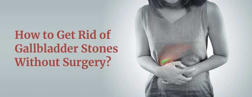 Treating Gallstones Without Surgery