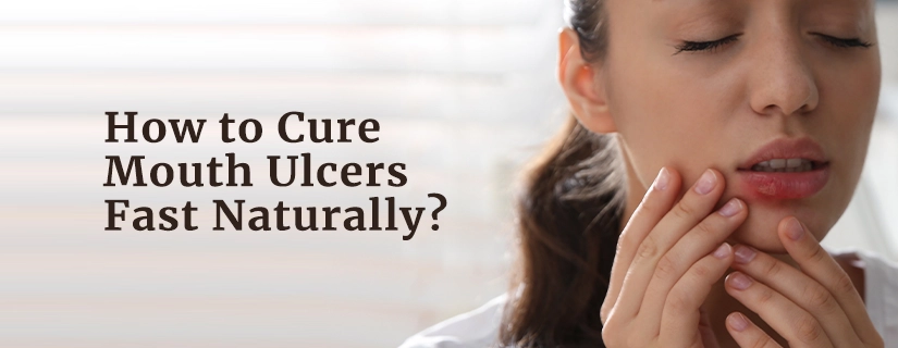 How to Cure Mouth Ulcers Fast Naturally?