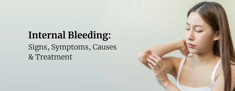 Internal Bleeding