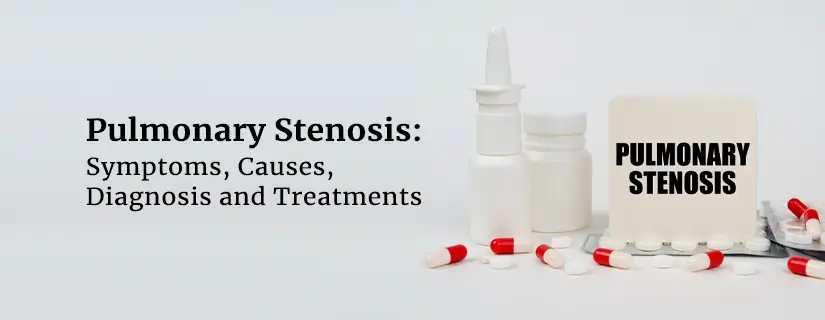Pulmonary Stenosis: Symptoms, Causes, Diagnosis and Treatments