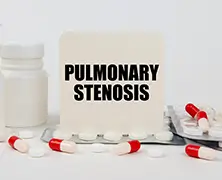 Pulmonary Stenosis: Symptoms, Causes, Diagnosis and Treatments