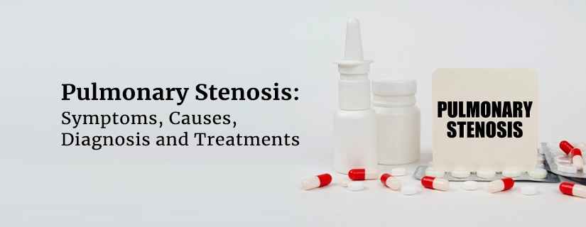 Pulmonary Stenosis: Symptoms, Causes, Diagnosis and Treatments