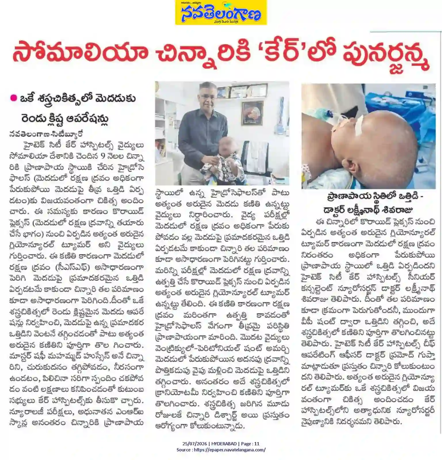 Somali Child Reincarnated at CARE Hospitals News Coverage in Nava Telangana