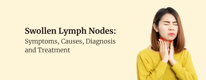 Swollen Lymph Nodes