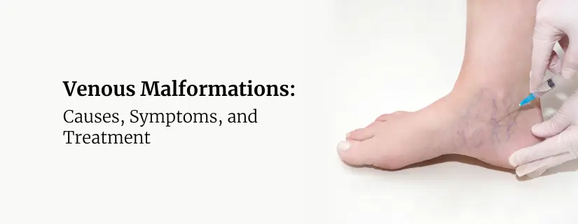 Venous Malformations