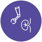 Best Hospital for Robot-assisted Pyelolithotomy Surgery in Vizag