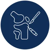 Above Knee Amputation