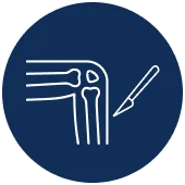 Below Knee Amputation
