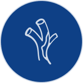 Carotid Angioplasty Surgery
