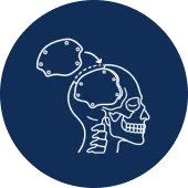 Cranioplasty