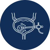 Cystolitholapaxy