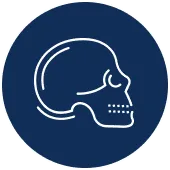 Decompressive Craniectomy Surgery