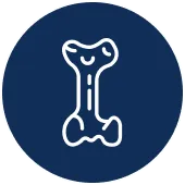 Femur Fracture Fixation