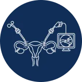 Laparoscopic Tubal Ligation