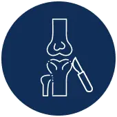 Limb Lengthening Surgery