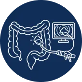 Polypectomy Surgery