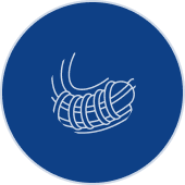 Stent Implantation Surgery