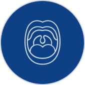 Tonsillectomy