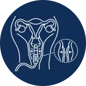 Vaginal Tightening