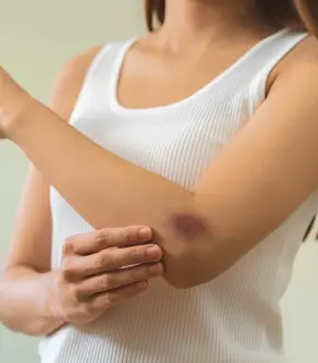 5 Internal Bleeding Symptoms You Should Never Ignore